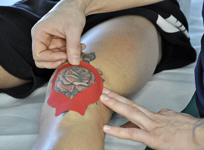 Kinesio Taping a Modena - Dott Luca Minopoli