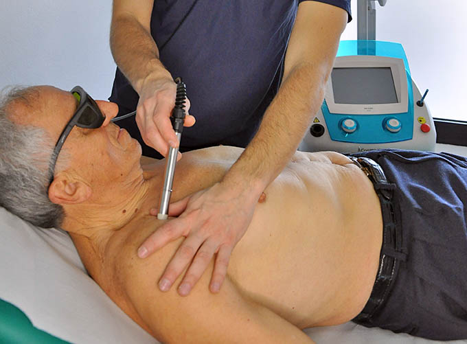 Laser terapia a Modena - Dott Luca Minopoli