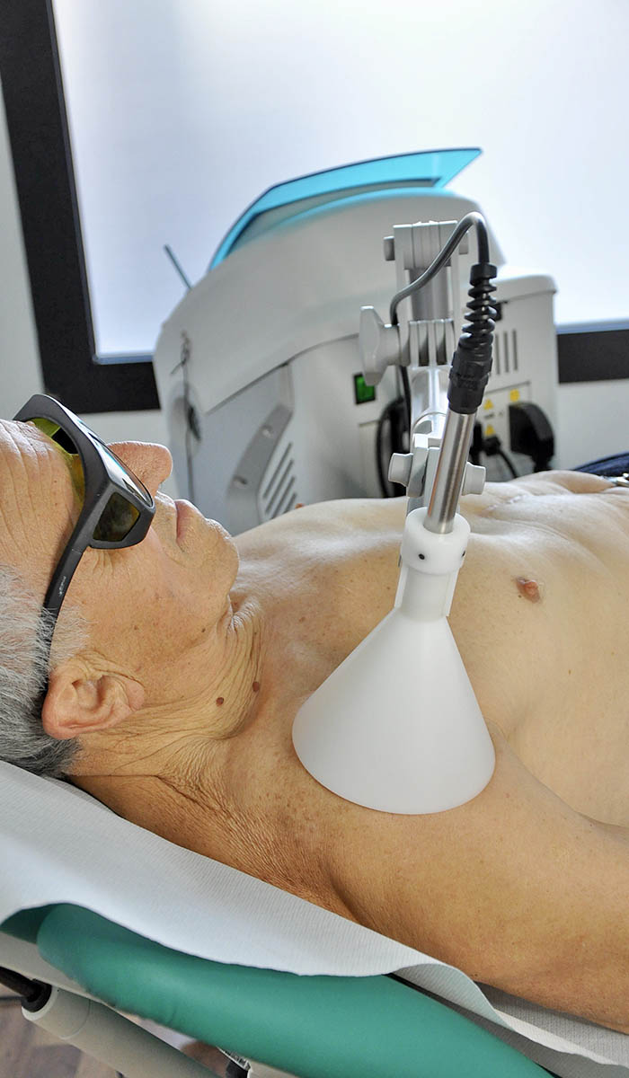 Laser terapia a Modena